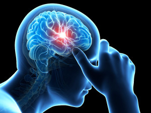 New treatment Migraine available in Memphis | WREG.com - Health Council New treatment Migraine available in Memphis | WREG.com - Health Council