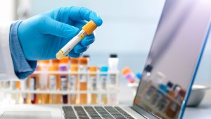 CDC tells doctors to stop testing patients for marijuana - Health Council CDC tells doctors to stop testing patients for marijuana - Health Council