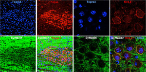 Scientists uncover new pathway for research in brain diseases - Health Council Scientists uncover new pathway for research in brain diseases - Health Council