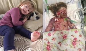 Meningitis B Vaccine Calls Rejected Despite Petition - BBC News - Health Council Meningitis B Vaccine Calls Rejected Despite Petition - BBC News - Health Council