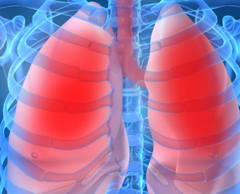 New Technology:View How Aggressive Lung Disease Develops - Health Council New Technology:View How Aggressive Lung Disease Develops - Health Council