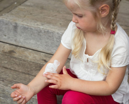 Children with Food-Triggered Eczema are at Risk for Life Threatening Food Allergy - Health Council Children with Food-Triggered Eczema are at Risk for Life Threatening Food Allergy - Health Council