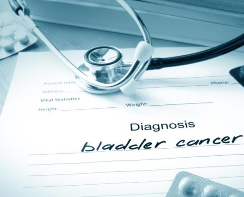 FDA Approved Drug 'Tecentriq' to Treat Bladder Cancer - Health Council FDA Approved Drug 'Tecentriq' to Treat Bladder Cancer - Health Council