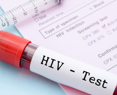 HIV Entry Mechanism Into immune Cell Nucleus Revealed - Health Council HIV Entry Mechanism Into immune Cell Nucleus Revealed - Health Council