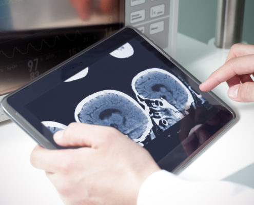 Ovarian Cancer: New Imaging Technique Helps Surgeons Remove More of Tumor - Health Council Ovarian Cancer: New Imaging Technique Helps Surgeons Remove More of Tumor - Health Council