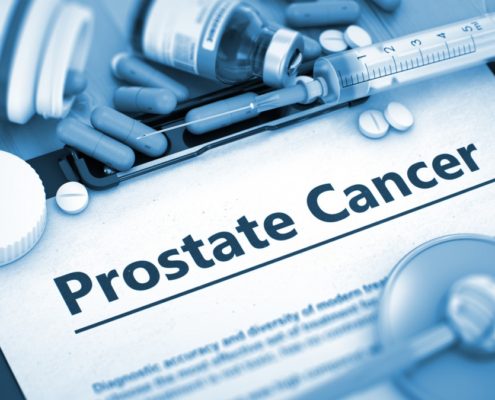 Common Prostate Cancer Treatment May Increase Risk for Alzheimer's - Health Council Common Prostate Cancer Treatment May Increase Risk for Alzheimer's - Health Council