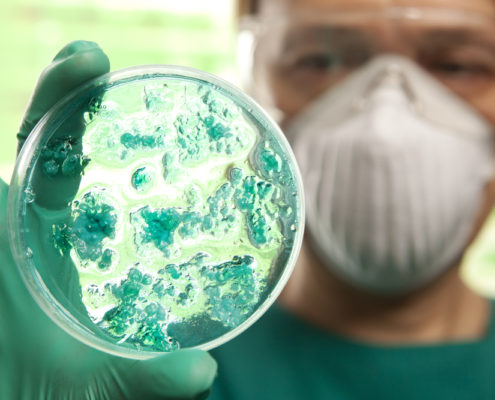 How Pathogenic Bacteria Hang on to Mucosa and Avoid Exfoliation - Health Council How Pathogenic Bacteria Hang on to Mucosa and Avoid Exfoliation - Health Council