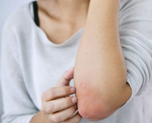 Psoriasis - American Health Council Psoriasis - American Health Council