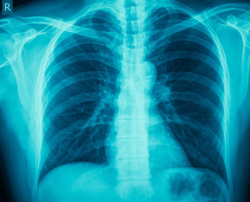 COPD - American Health Council COPD - American Health Council