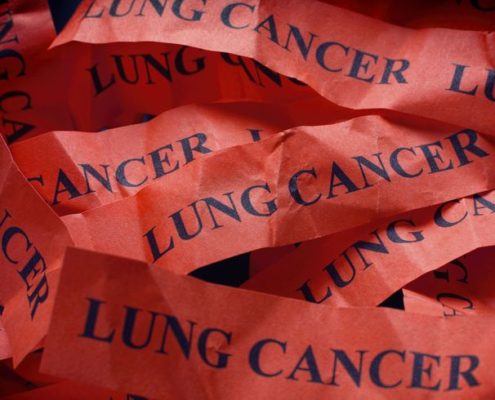 Lung Cancer - AHC Lung Cancer - AHC