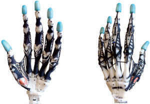 prosthetic hand prosthetic hand