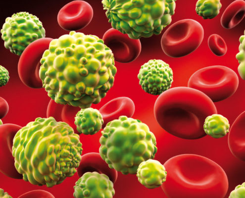 New Insights Into Cancer Cell Signaling Could Help Prevent Metastases - Health Council New Insights Into Cancer Cell Signaling Could Help Prevent Metastases - Health Council