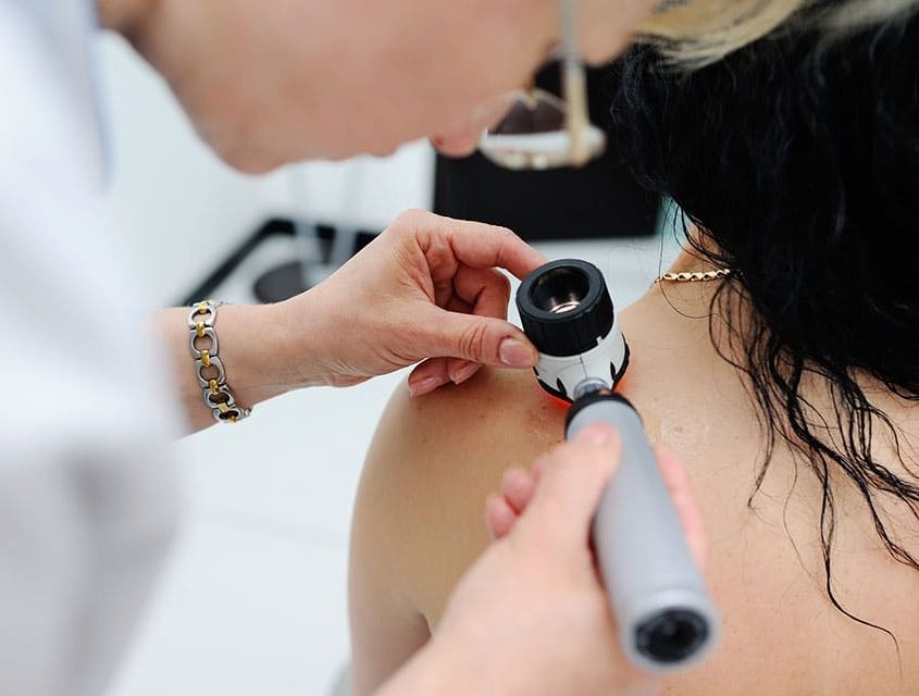 Melanoma - American Health Council Melanoma - American Health Council