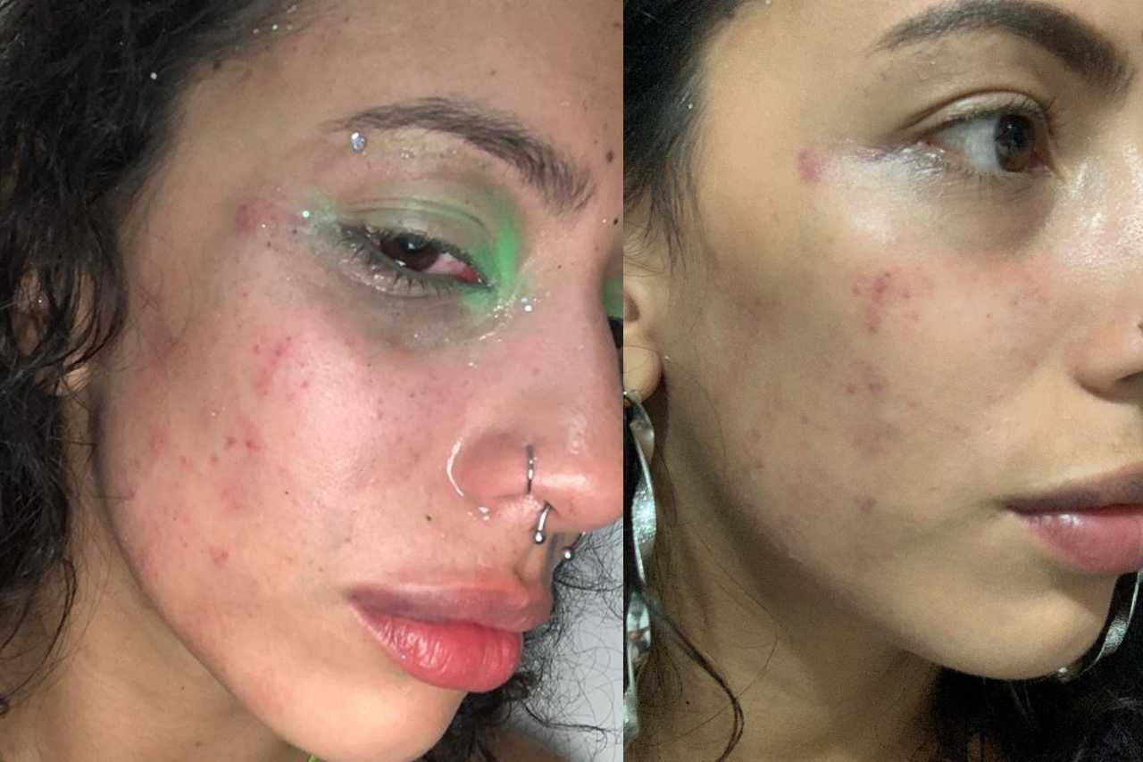 Polícia Civil investiga agressão contra advogada no Bloco do Parque 10