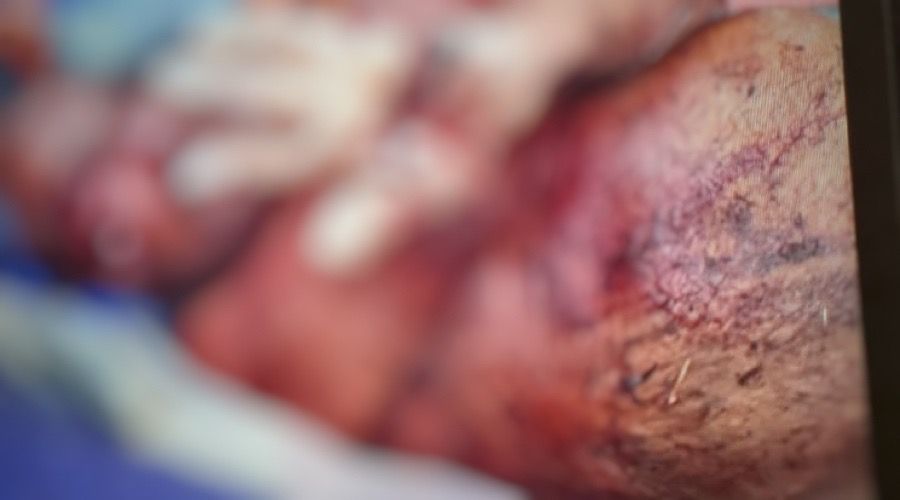 Garotos matam idoso com terçado para roubar farinha