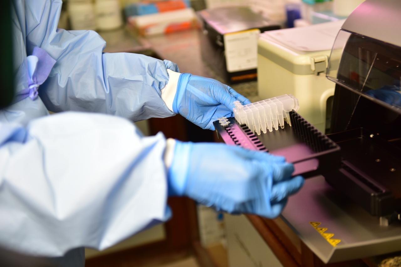 Amazonas registra mais 464 casos de coronavírus