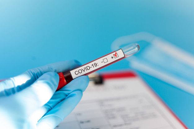 Amazonas registra 23 mortes por coronavírus