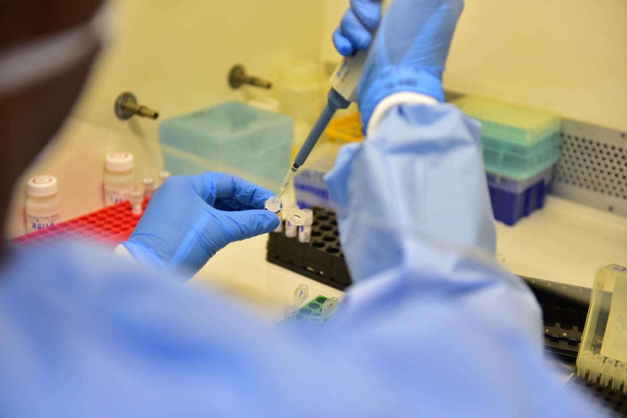 Amazonas amplia oferta de testes de coronavírus no interior