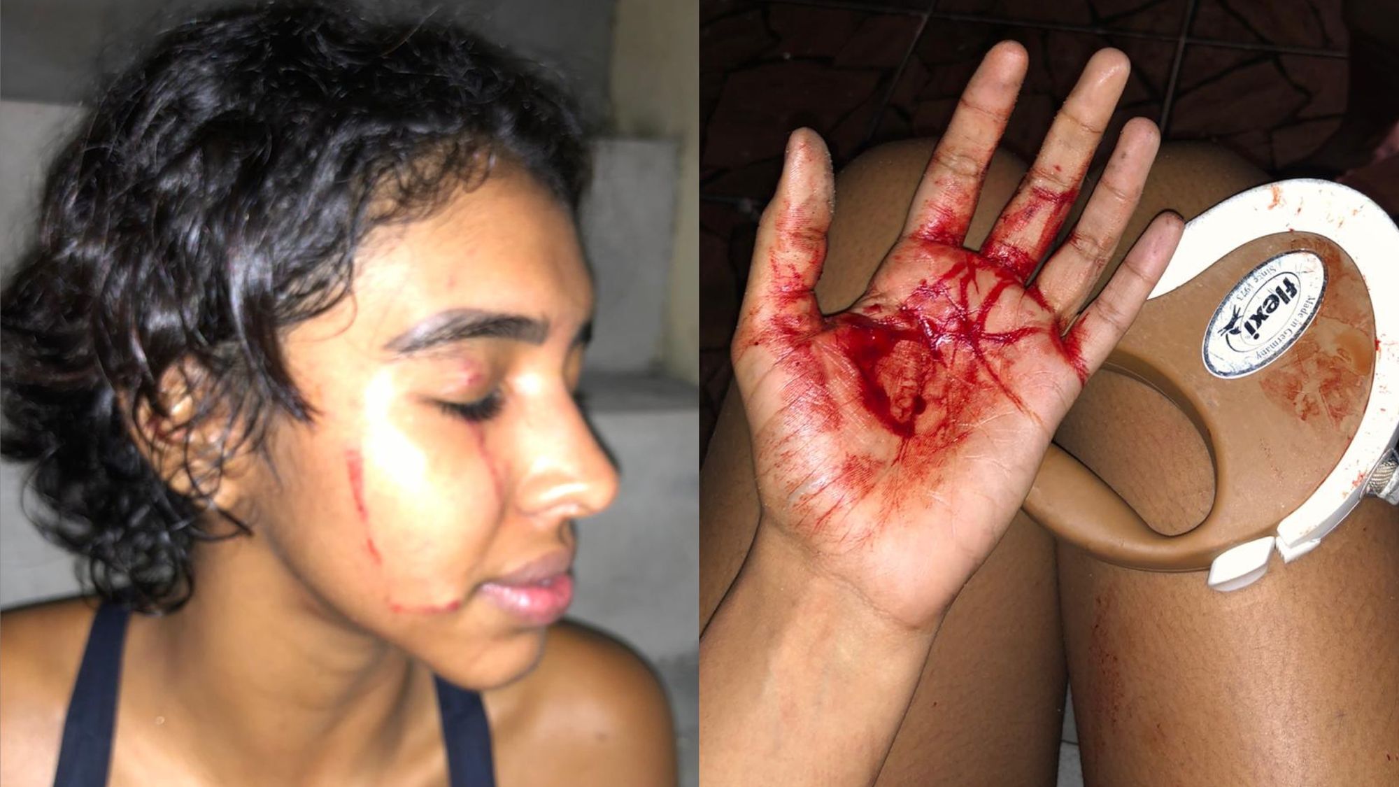 Mulher denuncia familiares de ex-comandante dos Bombeiros por agressão e racismo