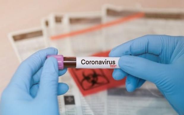 Boletim aponta 1.122 novos casos de Covid-19 no Amazonas