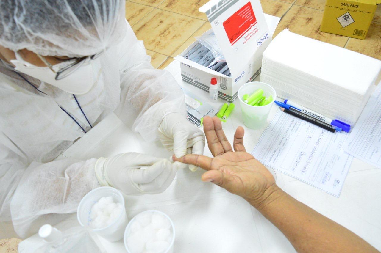 Policlínica Gilberto Mestrinho retoma testes de HIV, sífilis e hepatites