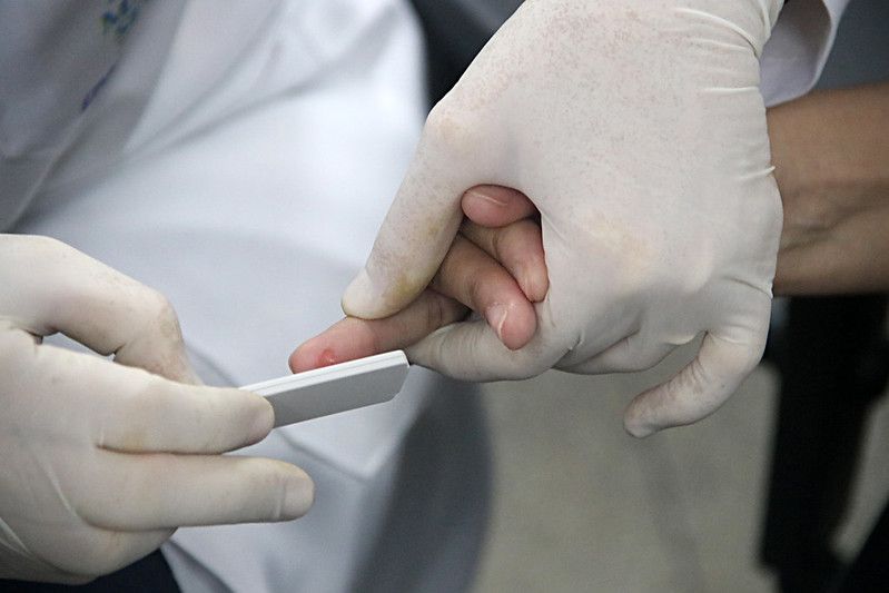 Amazonas tem mais 522 casos confirmados de coronavírus