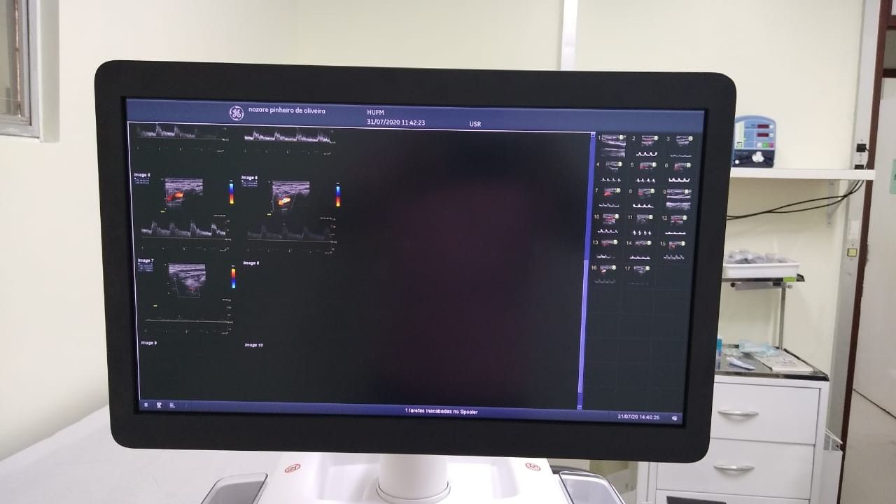 Francisca Mendes realiza primeiro exame de Ecocardiograma 3D do AM