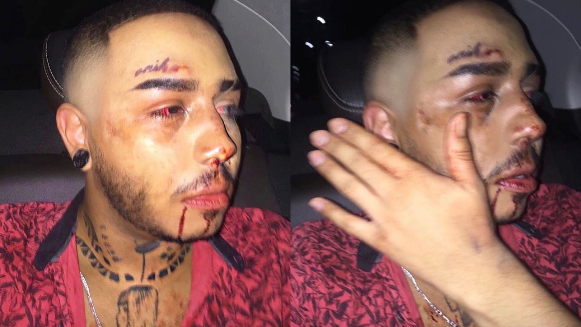 Jovem diz que foi espancado por motorista de App em Manaus