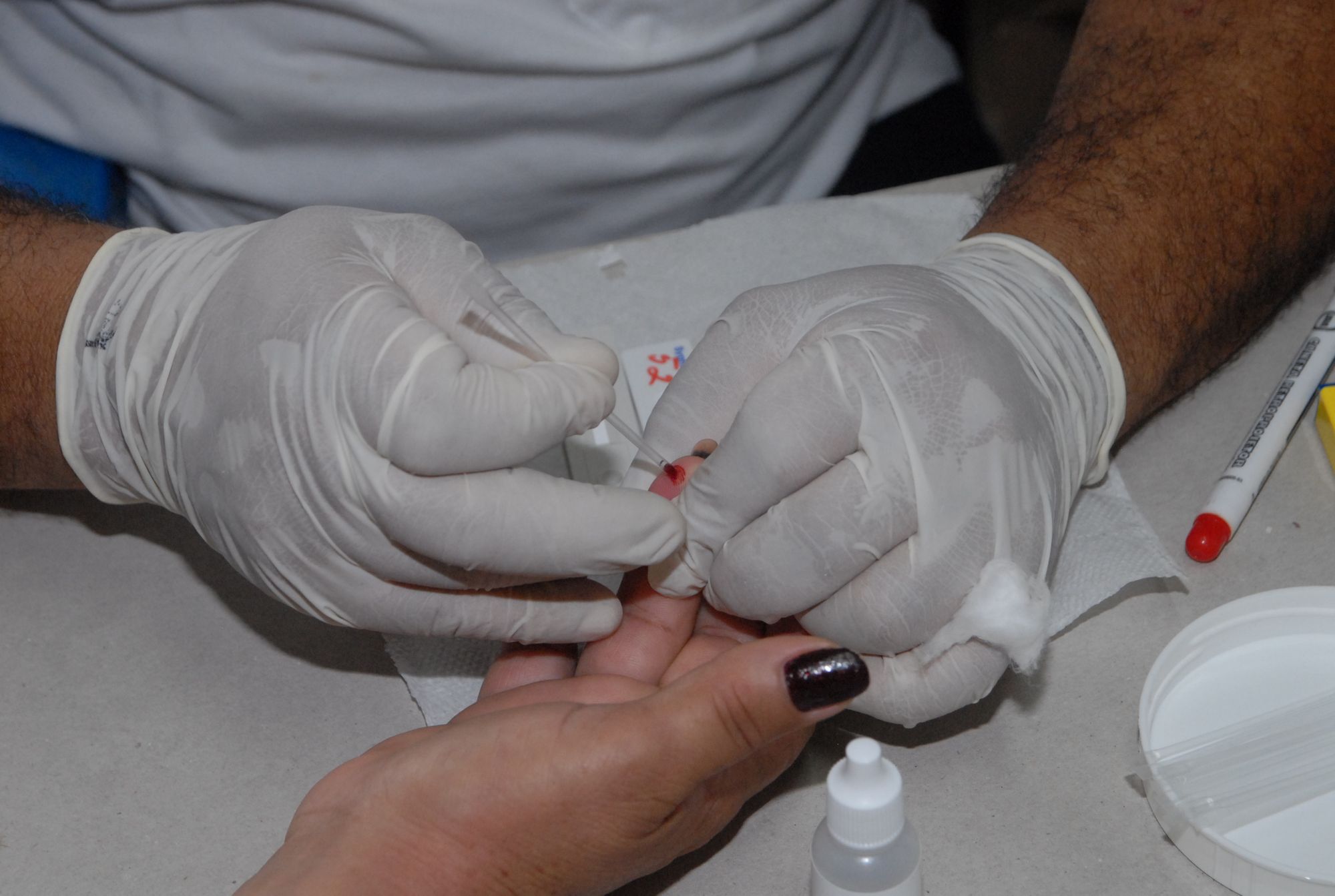 Trabalho de busca ativa para detecção de novos casos de hanseníase é reforçado