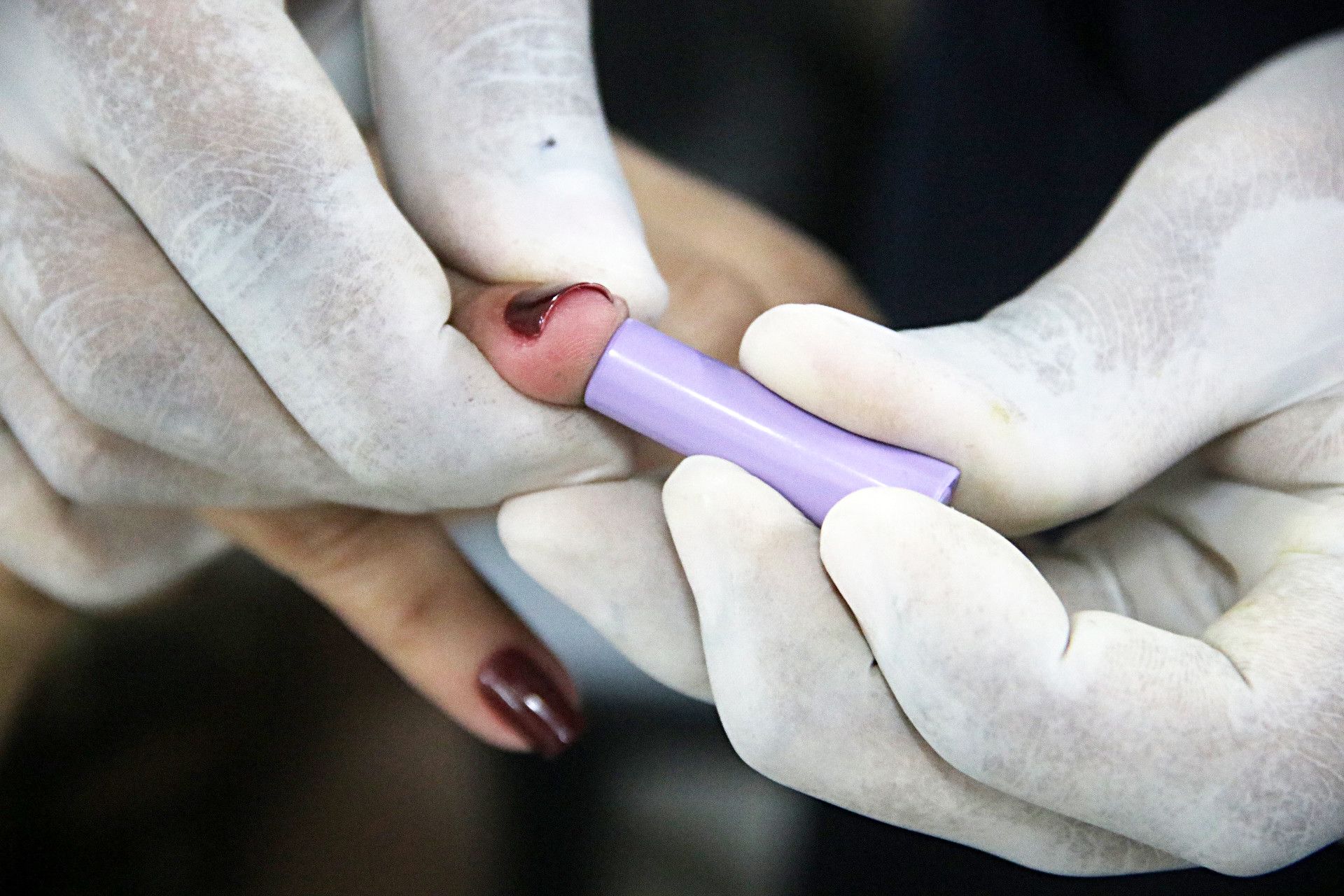 Amazonas confirma mais 85 casos e 6 mortes por coronavírus