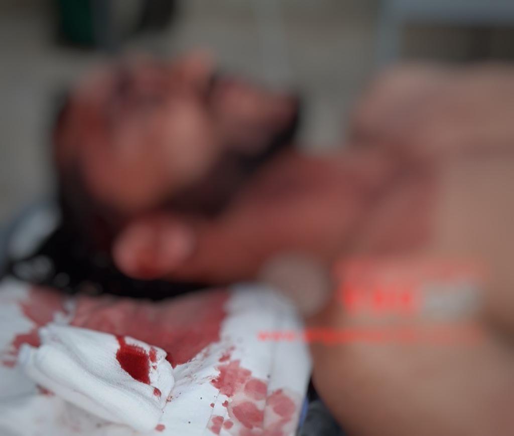 Vereador é torturado e obrigado a abandonar campanha política