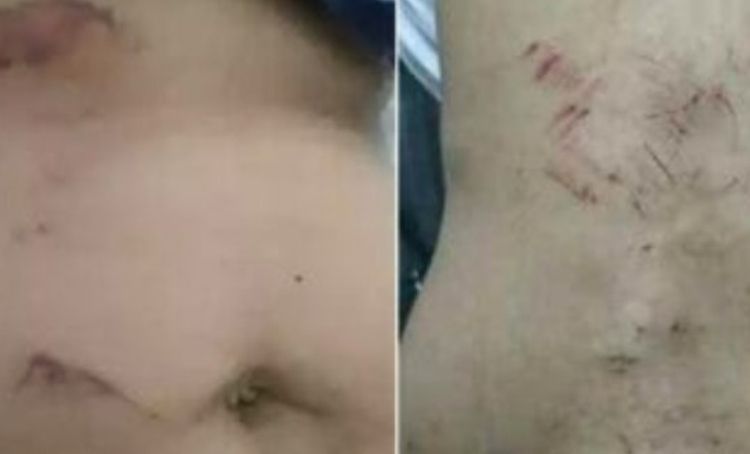 Após suspeitar traição, policial faz mulher comer cacos de vidro