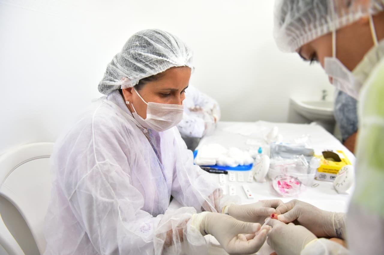 Amazonas registra redução no diagnóstico de HIV em 2020