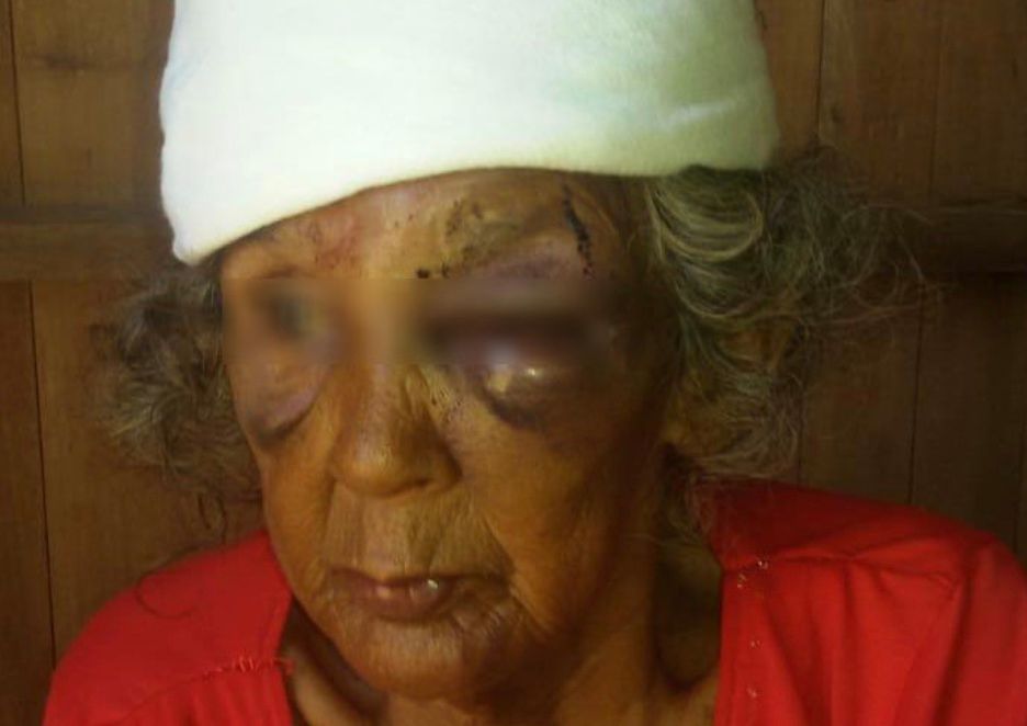 Criminosos espancam idosa de 76 anos no Amazonas