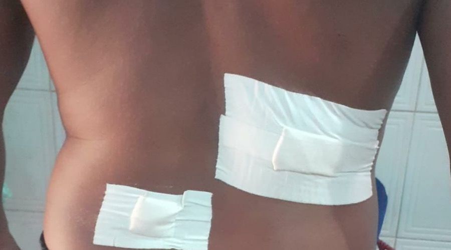 Homem é esfaqueado após confusão com presidente do Sinpol