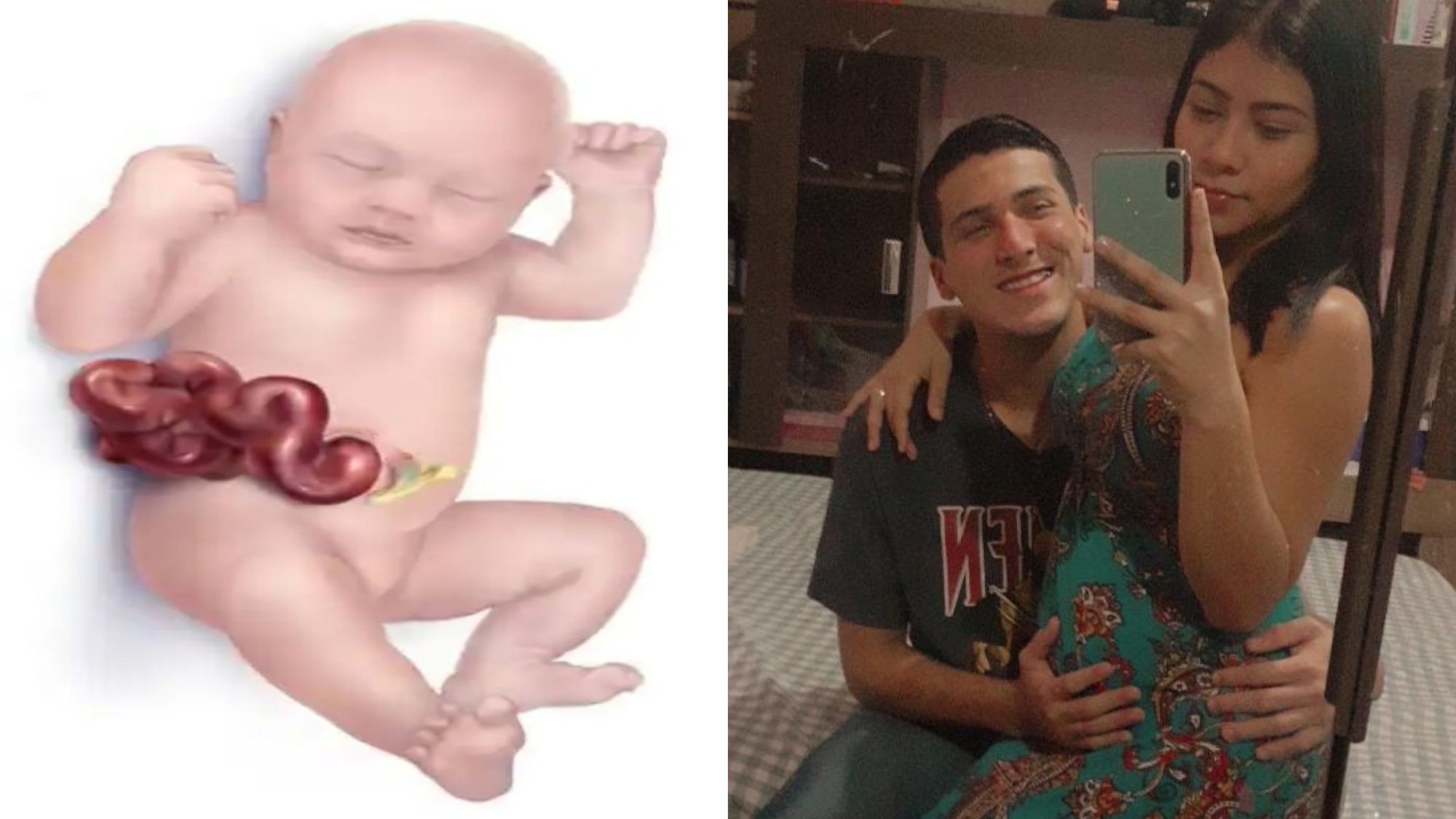 Pais pedem ajuda para o tratamento de bebê com doença rara em Manaus