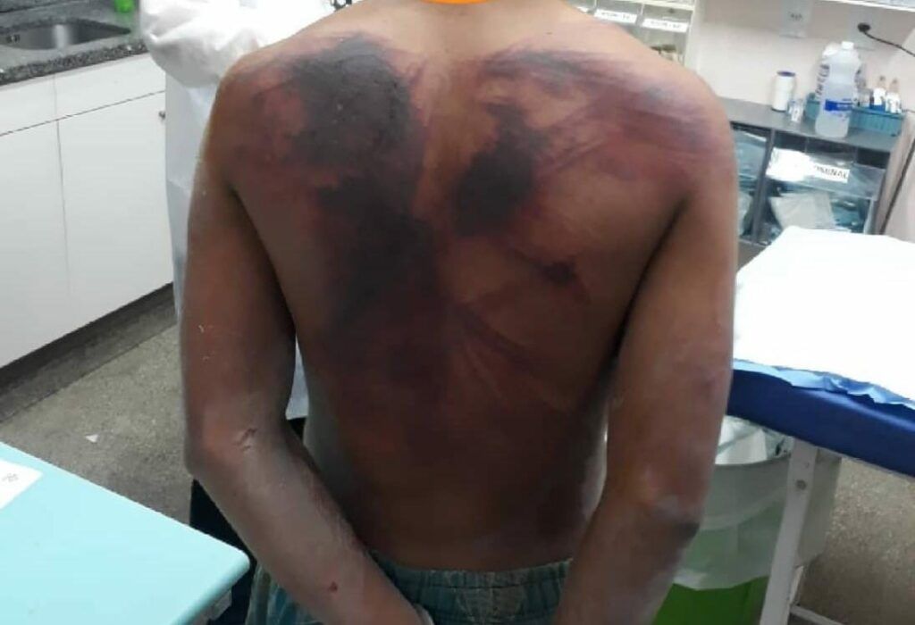 Homem fica cego após filho o atingir a golpes de terçado