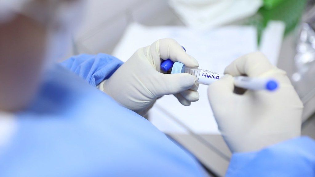 FVS-RCP monitora casos da variante Delta em Maués