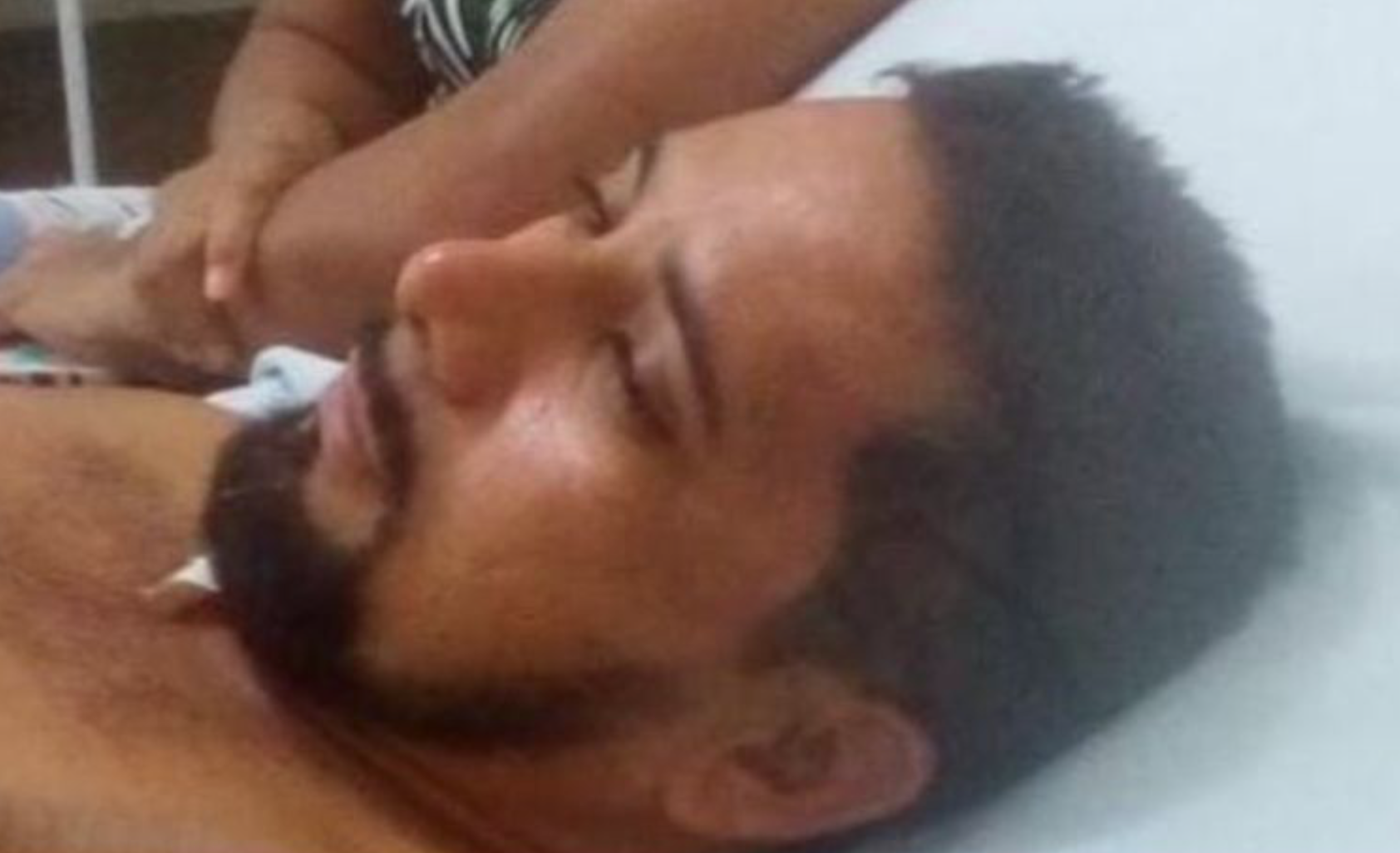 Taxista é furado no pescoço durante corrida em Maués