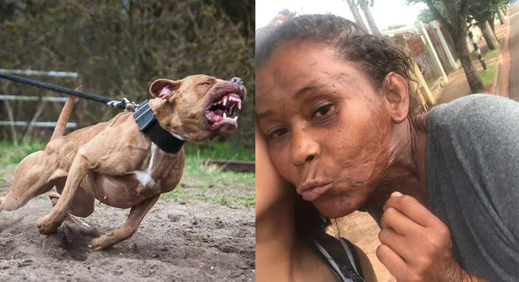 Mulher morre após ser atacada por 3 pitbulls na rua