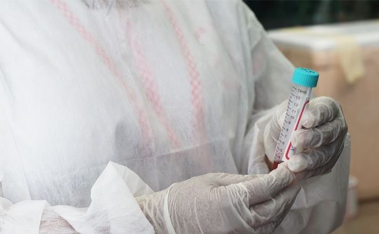 Amazonas confirma mais quatro casos de coinfecção por Covid e Influenza