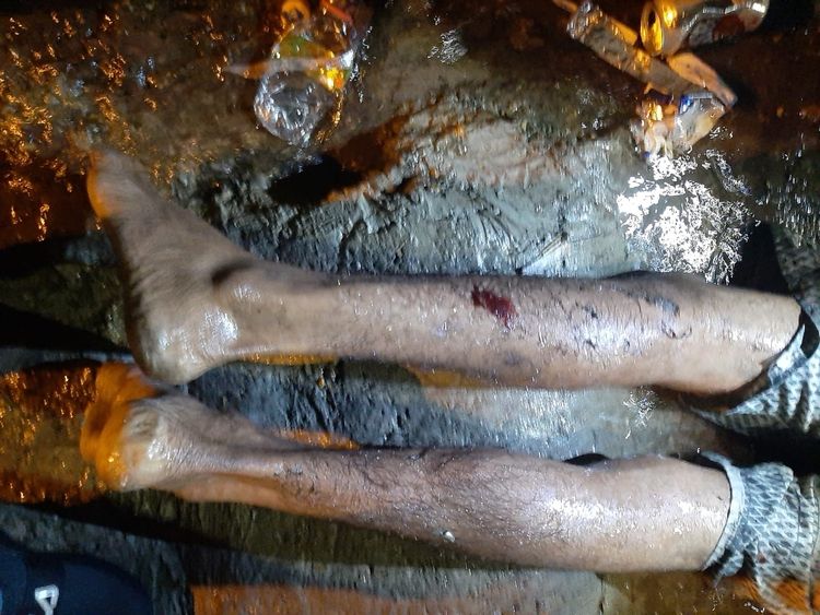 Homem é morto a tiros e facadas na Compensa