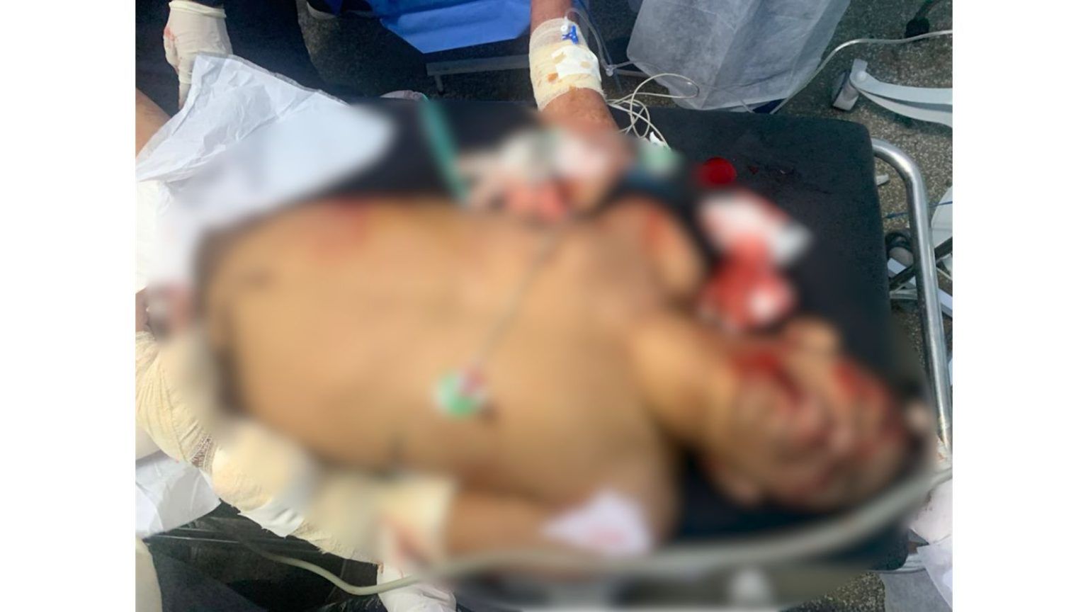 Homem é morto por "amigo" durante discussão por mulher