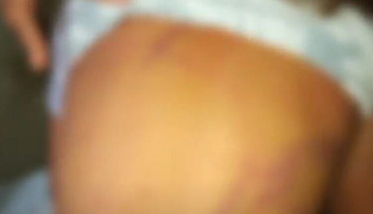 Pai espanca filhos com fio elétrico após darem salsicha para cachorro no AM