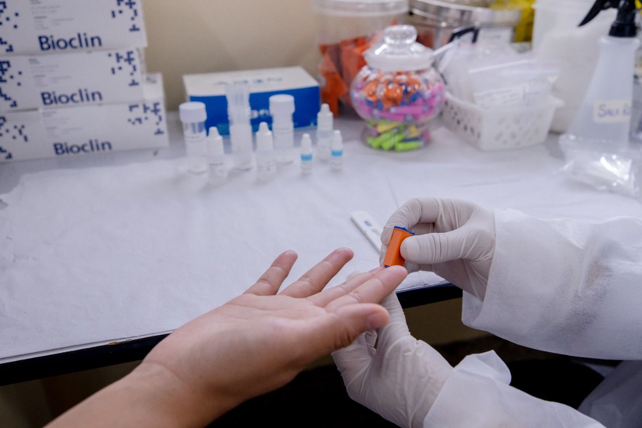 Manaus registra 70 casos de hepatites virais em 2022