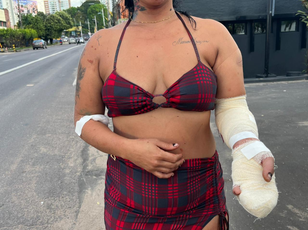 Com ciúmes, homem desfere terçadas na ex-mulher  em Manaus