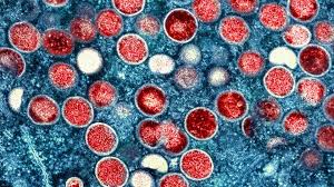 Sobe para 4 o número de casos de varíola dos macacos no AM