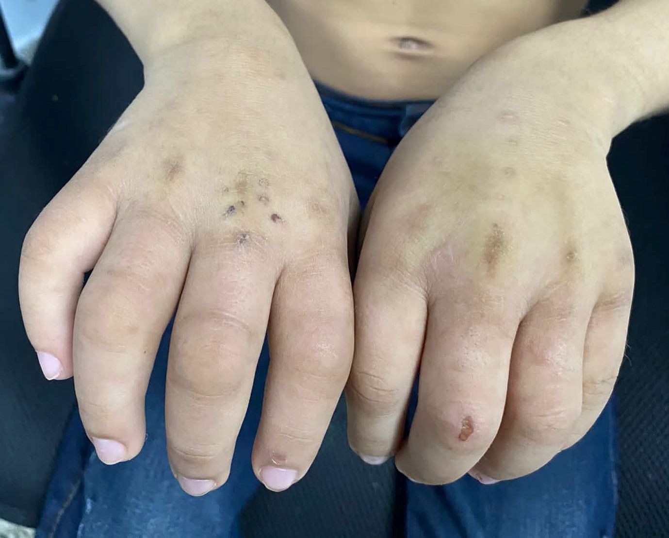 Mulher é presa suspeita de torturar sobrinho de 8 anos em Manaus