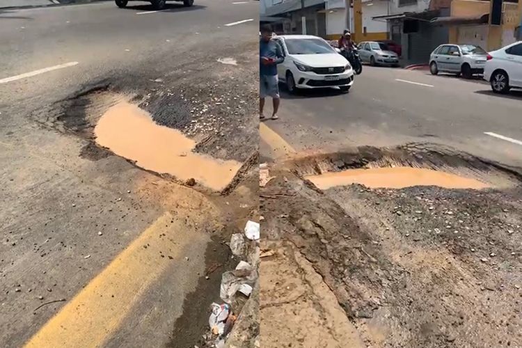 Mulher perde braço ao se acidentar em buraco na Comendador Clementino