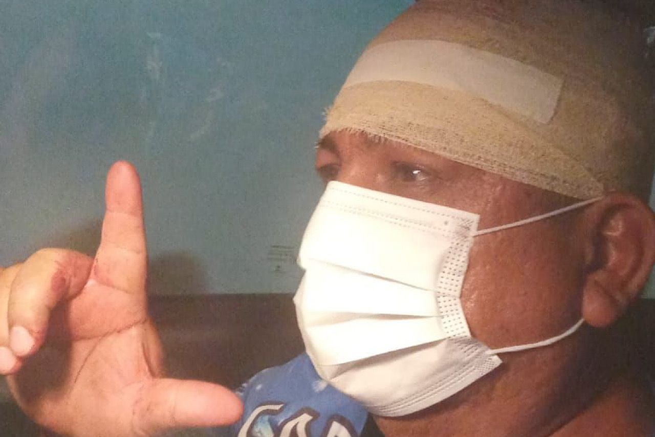 Bolsonarista atinge petista com barra de ferro em Manaus